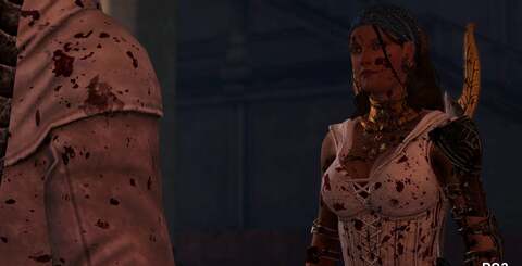 Other than the other differences we've pointed out, any major changes between the two console versions seem to be either bugs or technical curiosities.